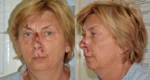 pu primorsko goranska